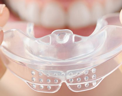 10 Reasons Invisalign Is a Popular Orthodontic Choice