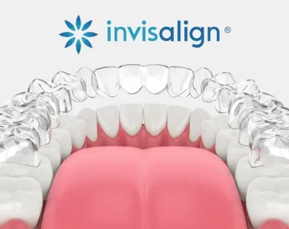8 Benefits of Invisalign Treatment for Straighter Teeth